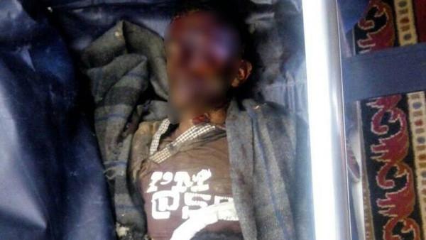 صورة مروعة لطفل لقي حتفه بلغم حوثي وسط اليمن