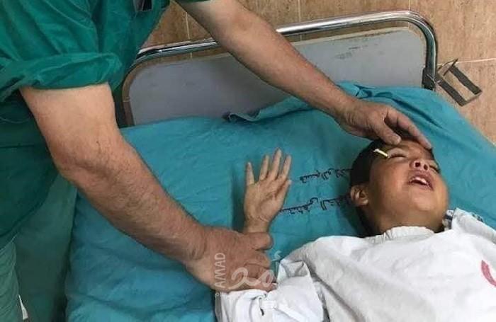 فريق طبي أمريكي ينجح بإزالة "قلم رصاص" من عين طالب في طولكرم- صور