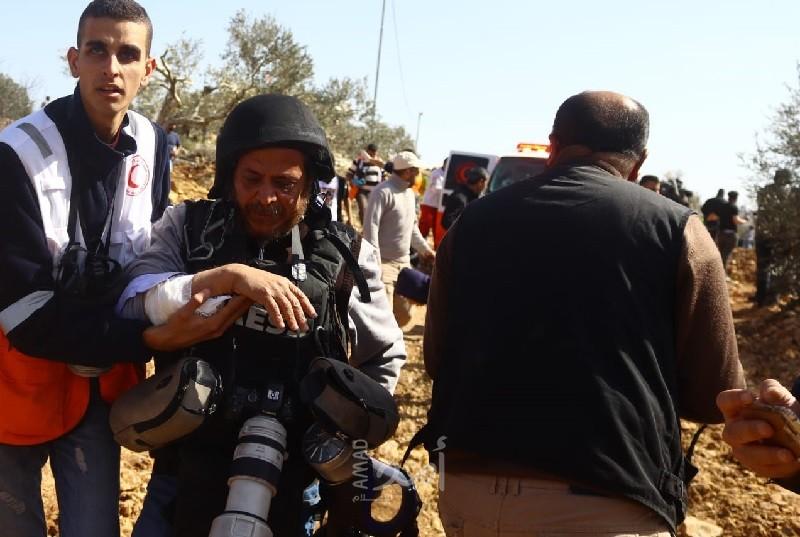 إصابات خلال قمع شرطة الاحتلال لتظاهرة حاشدة في الشيخ جراح- فيديو