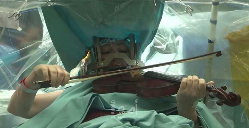 بالفيديو.. إيطالي يعزف على الساكسفون خلال إجراء جراحة دماغية معقدة لمدة 9 ساعات