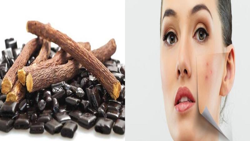 دور الهرمونات في تكوين حب الشباب