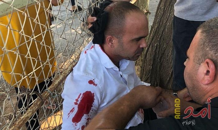 إصابات بقمع السلطات الإسرائيلية لمحتجين على هدم المنازل في سخنين (صور)