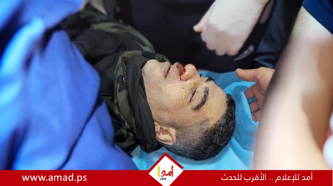 استشهاد شاب في هجوم للمستوطنين على بلدة قراوة بني حسان