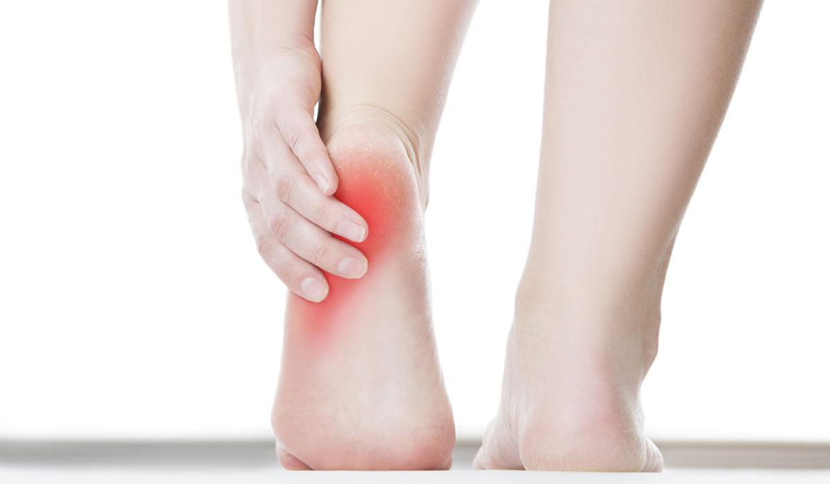 أسباب تشقق القدمين وعلاجه