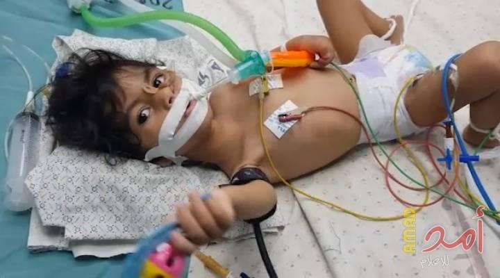 بالصور.. الطفلة "آمال فلفل" ترقد على أسرة مستشفى الهلال بالخليل والاحتلال يحرم والدتها من مرافقتها