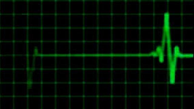 علماء يتوصلون إلى آلية إعادة الميت إلى الحياة