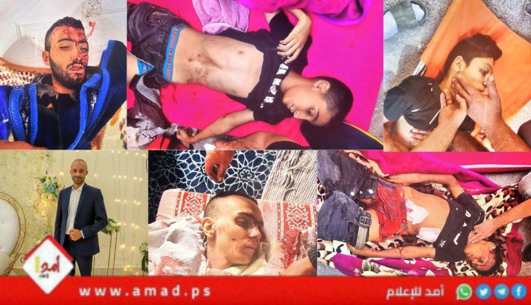 (88) شهيداً في الضفة الغربية منذ بداية "معركة طوفان الأقصى"