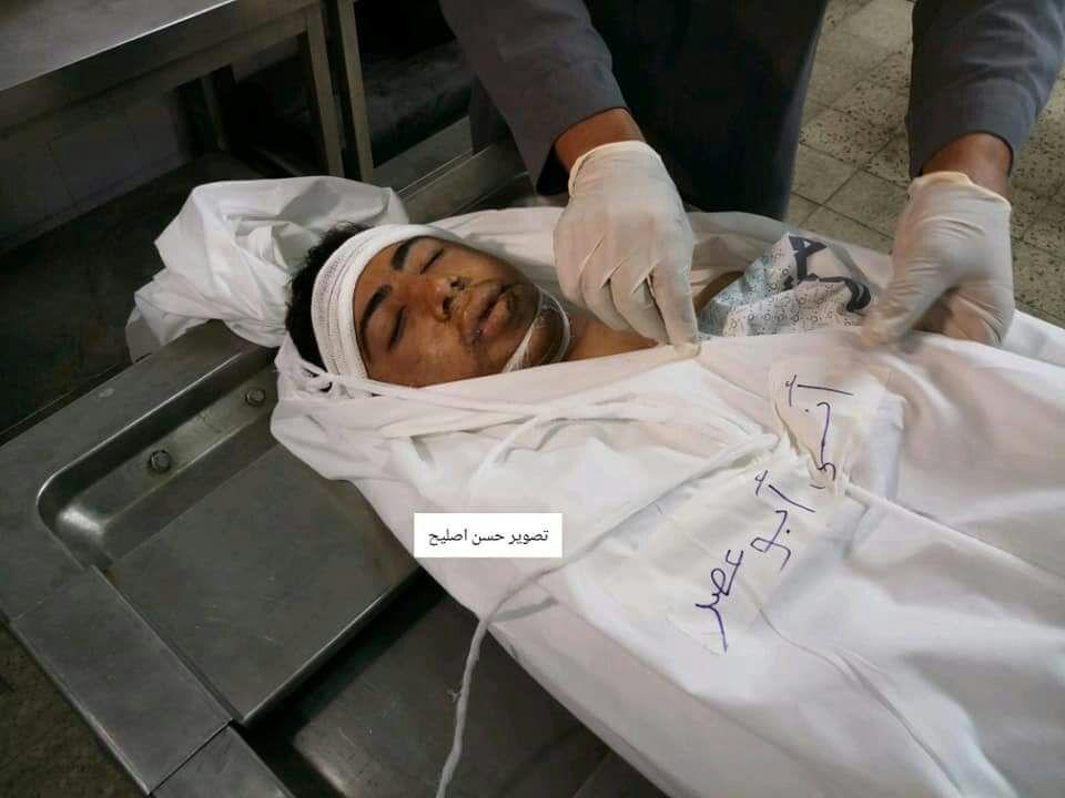 استشهاد "أنس أبو عصر" متأثراً بجراحٍ أصيب بها شرق غزة