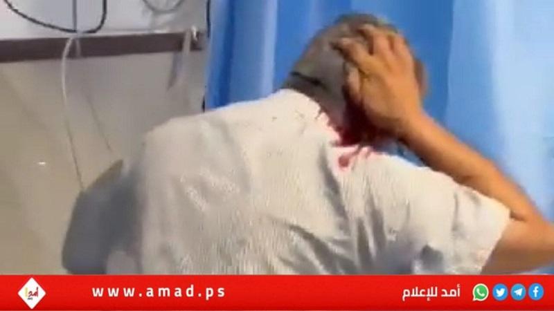 إصابة الصحفي "علي سمودي" بطلق ناري خلال تغطيته لمسيرة في جنين- فيديو