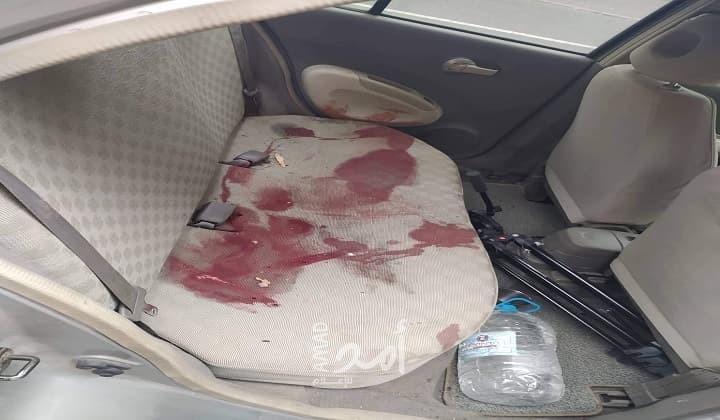 إصابة 4 صحفيين منهم فرنسيان جراء القصف الأذري في قره باغ