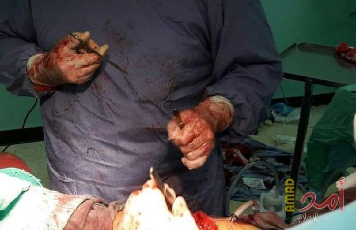 طاقم جراحة الصدر في "الأوروبي" ينقذ حياة مصابَين جراء تهتك الرئتين بالرصاص المتفجر