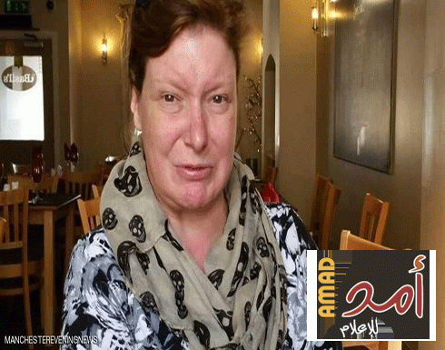 حالة نادرة.. امرأة لم تبتسم منذ أكثر من 30 عاماً