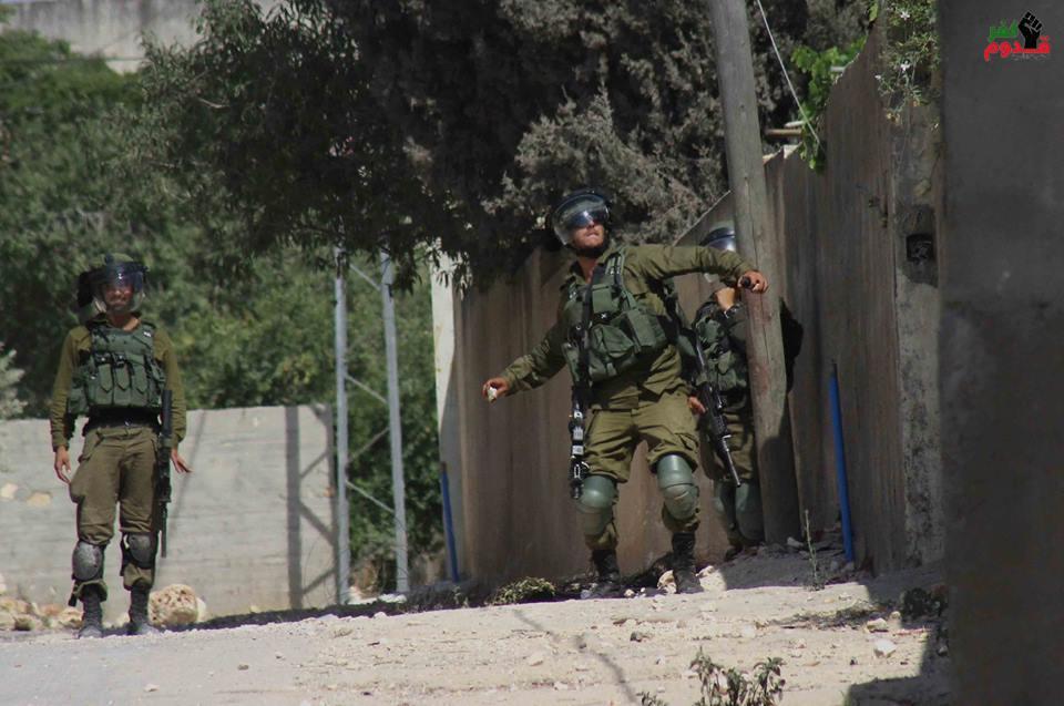 إصابة أربعة مواطنين بينهم صحفي برصاص جيش الاحتلال المعدني في كفر قدوم