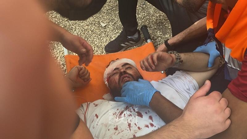 (32) عاماً على المجزرة الأولى في "المسجد الأقصى"