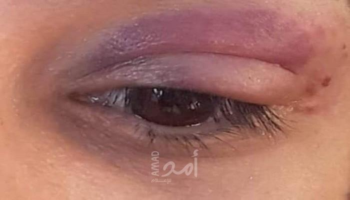 المحامية هبة نصير