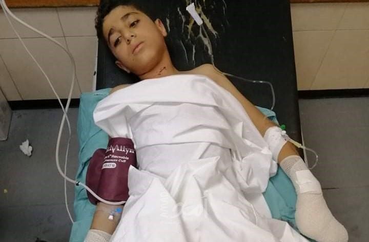 إصابة طفل في انفجار "جسم مشبوه" وسط قطاع غزة
