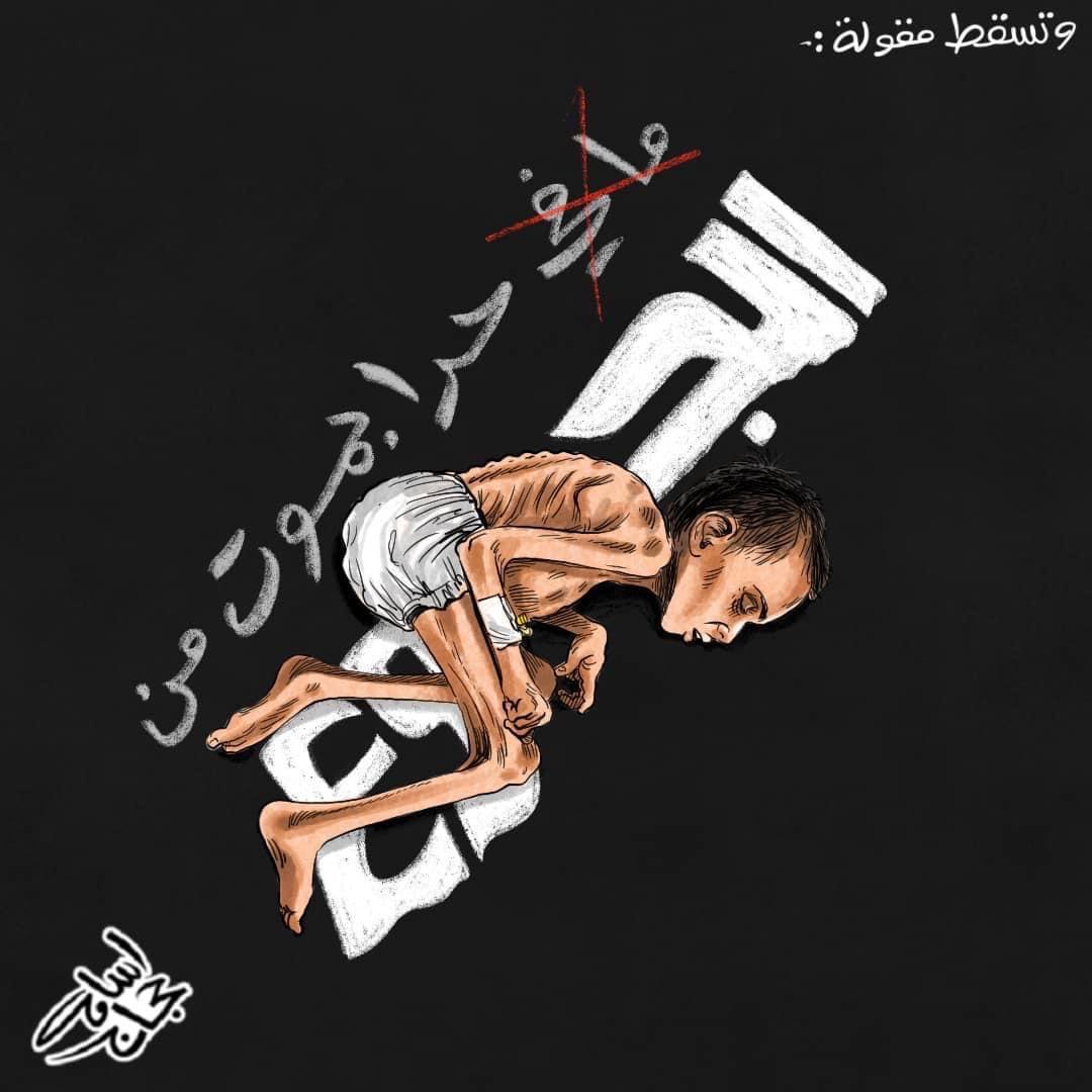 الموت من الجوع في غزة