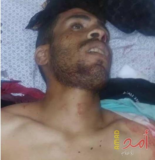 الصحة: استشهاد احمد عرفة شرق البريج برصاص قوات الاحتلال