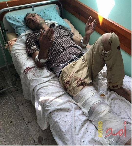 الهلال الأحمر: نقل المصور الصحفي محمد البابا إلى مستشفى "هداسا"
