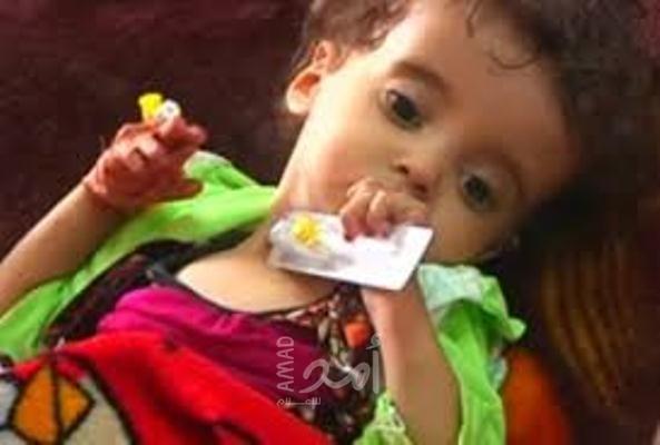 900 مريض في فلسطين:  مريض "الثلاسيميا" بين تكلفة العلاج الدائم وانعدام فرصة العمل