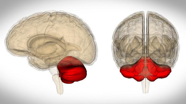 المخ البشري يدهش الطب مجددا.. امرأة ولدت بدون مخيخ