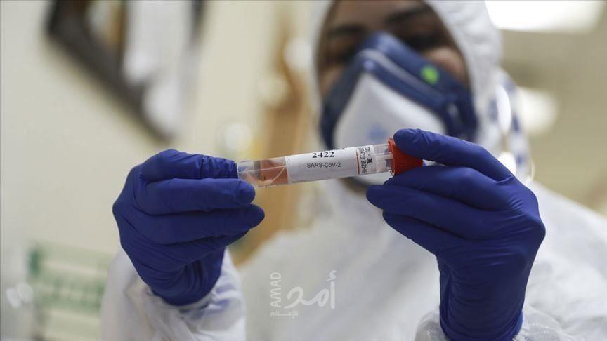 هام.. 3 أعراض جديدة تضاف إلى أعراض "كوفيد-19"