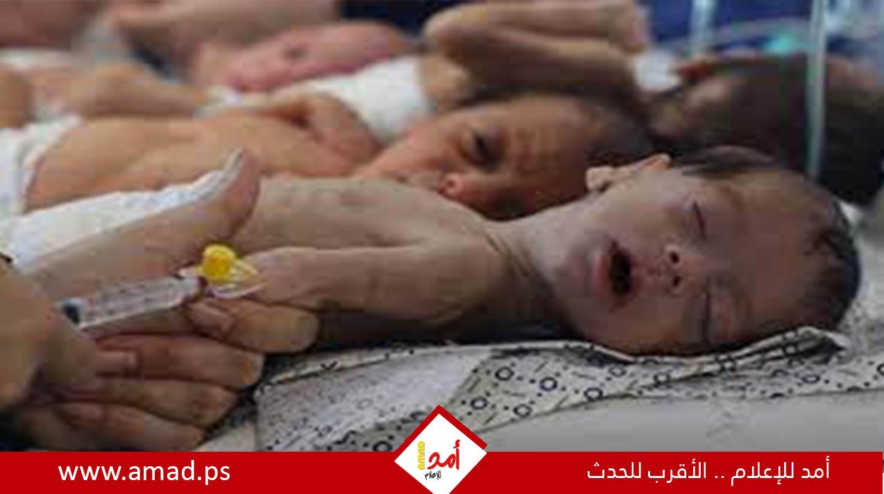  50 طفلا يعانون من سوء التغذية والمجاعة شمال قطاع غزة