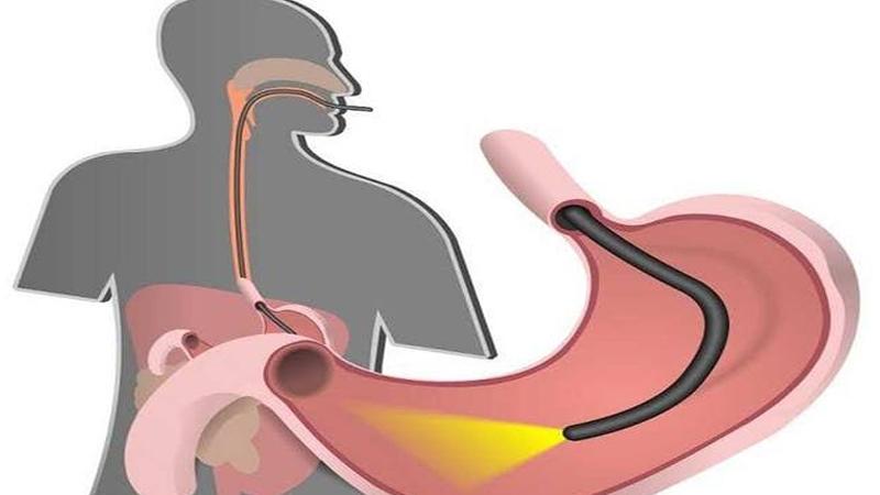 3 بذور طبيعية امضغها للتخلص من مشاكل المعدة