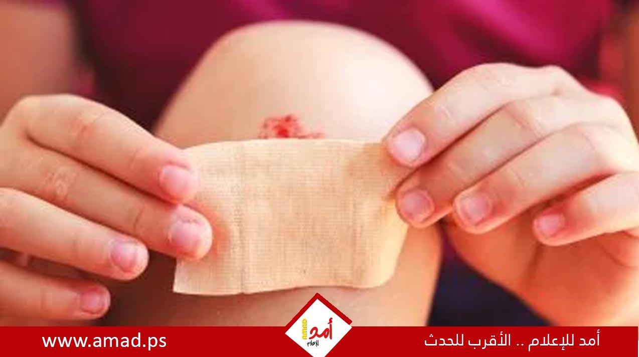 خبراء الصحة يحذرون من استخدام المناديل المبللة الخالية من الكحول على الجروح