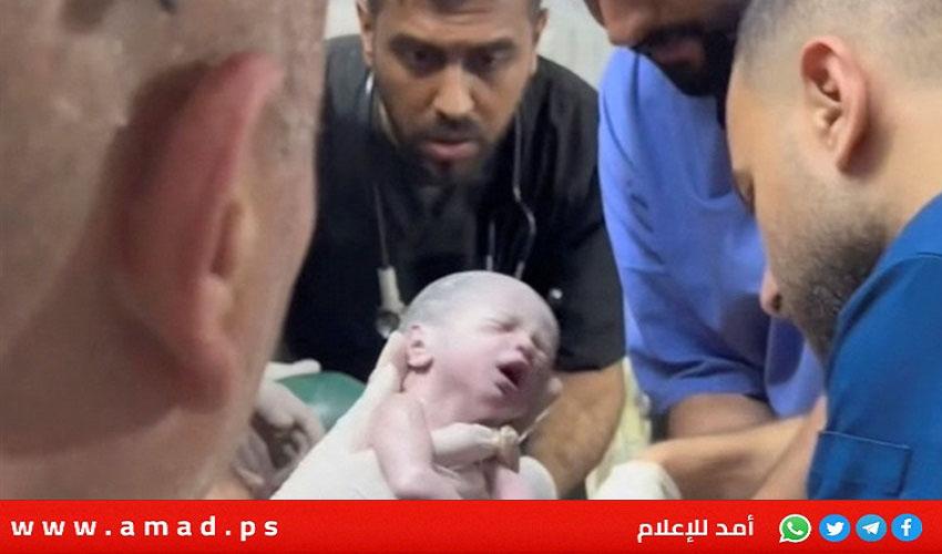 طبيب فلسطيني: وفاة "الطفلة المعجزة" بعد 4 أيام من ولادتها