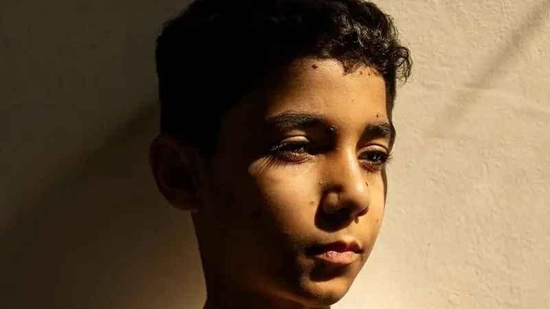 صورة طفل فلسطيني مصاب تفوز بجائزة "صورة العام"