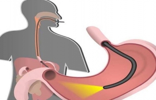 3 بذور طبيعية امضغها للتخلص من مشاكل المعدة