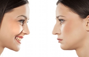 لماذا لا نمتلك نفس شكل الأنف؟