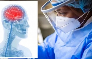 فيروس الشيكونجونيا.. أبرز أعراضه وأسبابه وطرق الوقاية والعلاج