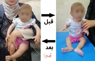 الهلال الأحمر الفلسطيني ينقذ: صور نجاحات في مكافحة سوء التغذية- صور