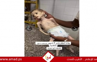 الجوع ينهش أجساد الأهل في غزة