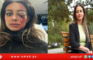 أستراليا.. هانا توماس مرشحة سابقة لـ"الخضر" قد تفقد بصرها من أجل فلسطين! صور