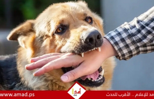 ماذا تفعل إذا تعرض طفلك لعضة أو خدش من كلب؟