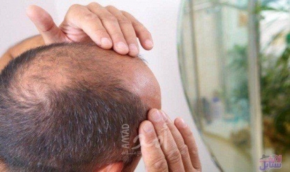 خدعها بـ"بروكة".. سيدة هندية ترفع دعوى قضائية ضد زوجها لإخفاء صلعته