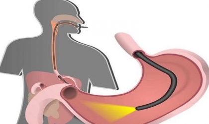 3 بذور طبيعية امضغها للتخلص من مشاكل المعدة