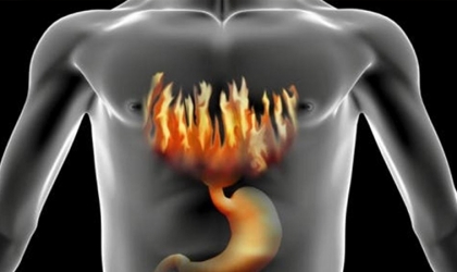 أفضل أطعمة لعلاج حموضة المعدة فى رمضان