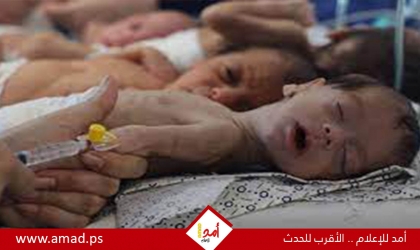 "الصحة العالمية": أطفال يموتون جوعا في مستشفيات شمال غزة
