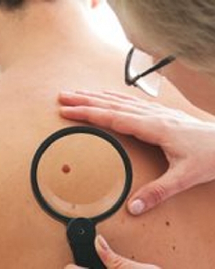 9 تغييرات على الجلد تشير إلى مشاكل صحية كامنة